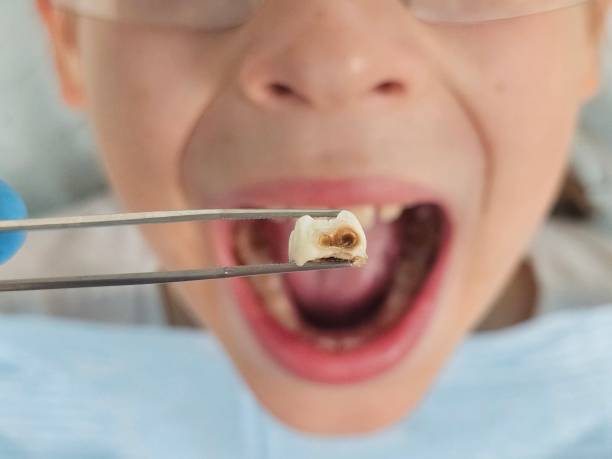Best Emergency Dental Services for Seniors in Pioneer, CA